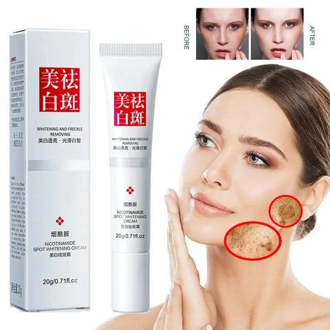 Crema facial que atenúa las pecas y las manchas oscuras. Crema blanqueadora con niacinamida y vitamina E.
